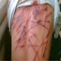 مصر: أهالى المعتقلين يكشفون تفاصيل تعذيب أبنائهم